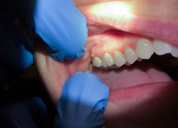 Best Emergency Orthodontic Services in Tatum, TX